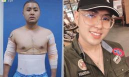 Sau ca 'dao kéo' 300 triệu, Akira Phan đã giảm được 4 kg 