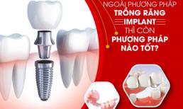 Ngoài trồng răng Implant thì còn phương pháp nào tốt?