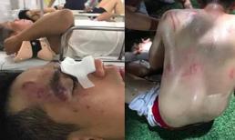 Công an Hoàng Mai vào cuộc điều tra vụ đội bóng phong trào bị đánh hội đồng