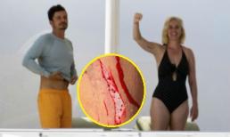 Đi du lịch với người tình nóng bỏng, Orlando Bloom bung hết sức để trèo lên đỉnh núi rồi nhận về cái kết đổ máu 