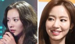 Mỹ nhân “Sắc đẹp ngàn cân” Kim Ah Joong lộ gương mặt ngày càng cứng đơ