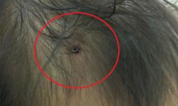 Hết hồn nhìn bé gái gần 2 tuổi sang nhà hàng xóm chơi bị bạn đóng đinh dài 1cm vào đầu