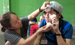 Trong buổi tổng duyệt chương trình, Minh Luân bị ngã đập mặt xuống sàn sân khấu