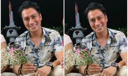 Sau gần 2 tháng phẫu thuật thẩm mỹ, Việt Anh gây thất vọng với gương mặt lạ nhưng kém sắc