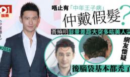 'Soái ca' Huỳnh Hiểu Minh bị hói, phải cậy nhờ đến công nghệ cấy tóc?