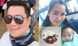 Sao Việt 30/8/2019: Việt Anh chụp cận mặt sau 'dao kéo'; Bữa cơm thanh đạm của ca sĩ Minh Hiền khi ở Sing chữa bệnh cho con