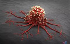 Ai cũng sợ mắc ung thư nhưng tế bào ung thư lại rất sợ nếu bạn đều đặn làm 7 việc này mỗi ngày