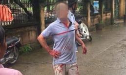 Thảm sát kinh hoàng tại Hà Nội, cả nhà 5 người bị chém thương vong