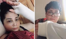 Đi giữa trời Hà Nội mưa to, NSND Minh Hằng bị ngã gãy tay