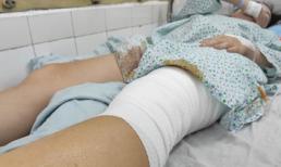 Nữ cổ động viên kể khoảnh khắc bị pháo sáng ném vào chân ở Hàng Đẫy