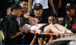 Pháo sáng trên sân Hàng Đẫy khiến nữ phóng viên bị bỏng nặng vào tận xương, phải mổ chân