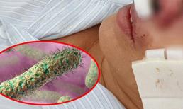 Bệnh Whitmore - vi khuẩn 'ăn thịt người' thực sự nguy hiểm thế nào?