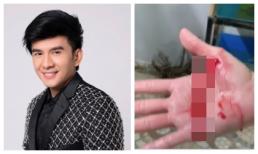 Lỡ tay nghịch cá, Đan Trường bị thương đến chảy máu tay không ngừng