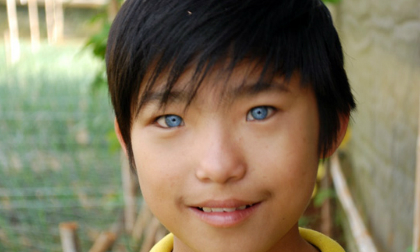 Kỳ lạ cậu bé có đôi mắt... búp bê ở Đà Lạt