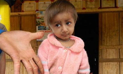 Chuyện lạ Việt Nam: Bất ngờ với những em bé đặc biệt