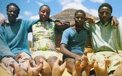 Kỳ lạ tộc người chỉ mọc hai ngón chân 