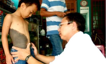 Tìm ra bệnh bé 'người sói' ở Quảng Nam