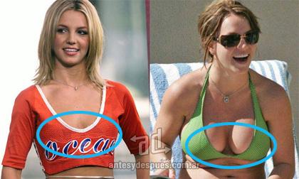 Top người đẹp sở hữu vòng 1 "xẹp nở" nhờ dao kéo