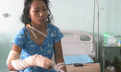 Chồng chém vợ cụt 2 ngón tay, đứt bánh chè