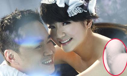 Chồng Selina âu yếm hôn vết sẹo của vợ