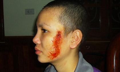 Lời kể của 2 chị em cô gái bị xăm mặt 