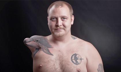 Sáng tạo độc đáo từ một cánh tay cụt