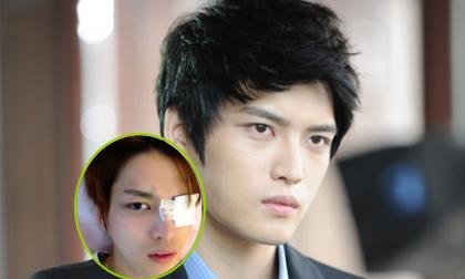 Fans bất ngờ khi Jae Joong (JYJ) phải đeo bông băng trên mắt
