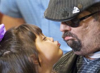 Người ghép toàn bộ mặt đầu tiên trình diện 