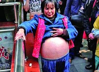 Mặc cảm vòng 2 quá khổ, tự dùng dao mổ bụng