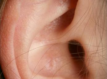 Kiến làm tổ trong…. tai thiếu nữ 16 tuổi!