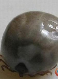 Trung Quốc: Xuất hiện bọ chét độc đốt chết 4 người, 71 người nhập viện