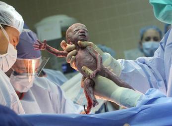 Sinh 6 con trong vòng 3 phút