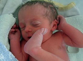 Bé gái sinh ra với vị trí chân kì lạ