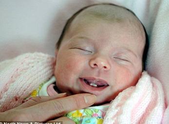 Vừa chào đời đã có 2 răng cửa