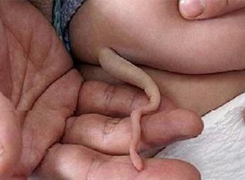 Kinh ngạc hình ảnh người mọc đuôi