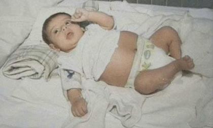 Em bé 1 tuổi đã mang thai