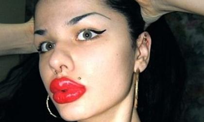 Đôi môi dày và to kỳ lạ 