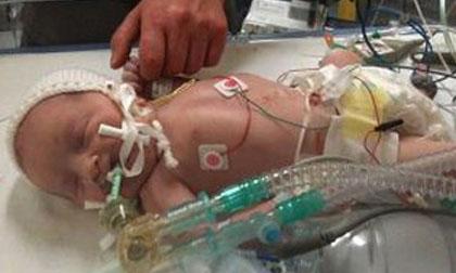 Lạ kỳ cậu bé sinh ra không có… máu