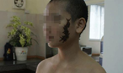 Vụ ép thiếu nữ xăm hình quái vật: Khởi tố 2 người