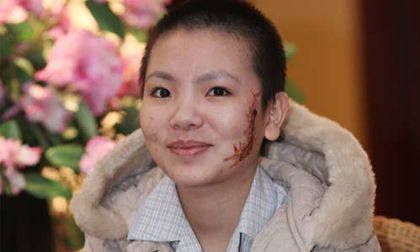 Cô gái bị xăm rết lên mặt khóc nức nở vì xúc động