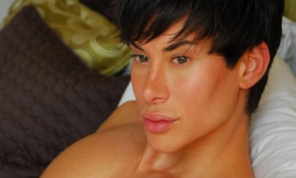 Chàng trai phẫu thuật thẩm mỹ... 90 lần