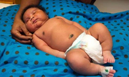 9 bé sơ sinh khổng lồ trên thế giới