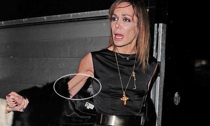 Cựu người mẫu Anh gây sốc với cánh tay gầy như "ma đói"