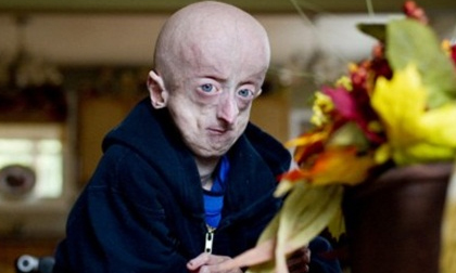 Gặp teen boy 16 tuổi “trong lốt” ông cụ 60