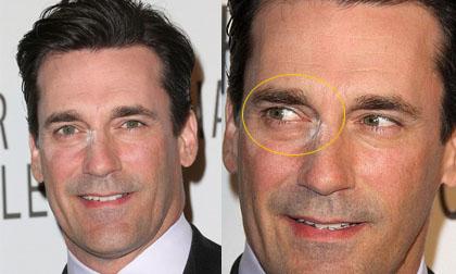 Tài tử Jon Hamm "bẽ mặt" vì làn da như mốc