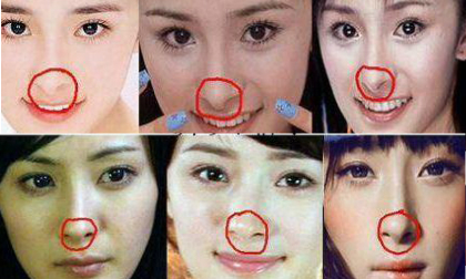 Nghi án Dương Mịch và hàng loạt sao Á phẫu thuật thẩm mỹ