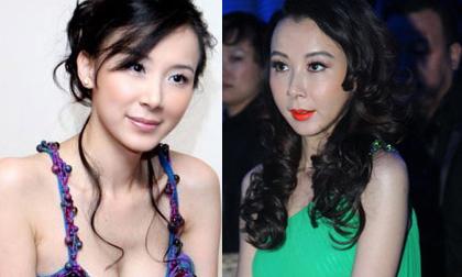 Tiêu Tường mặt "cứng đơ" vì "dao kéo"