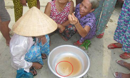 Bim bim có đỉa, người dùng hoang mang