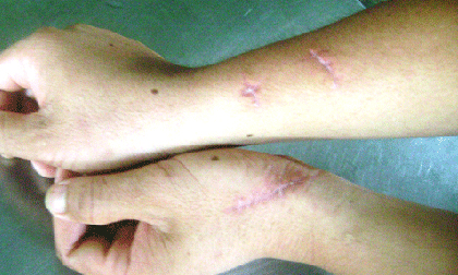 Khỉ 3 chân chuyên tấn công đàn ông ở Phú Yên