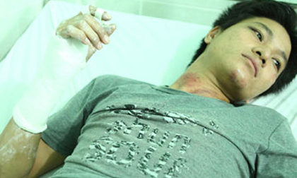 Bị công an đánh gãy tay vì không đội mũ bảo hiểm?